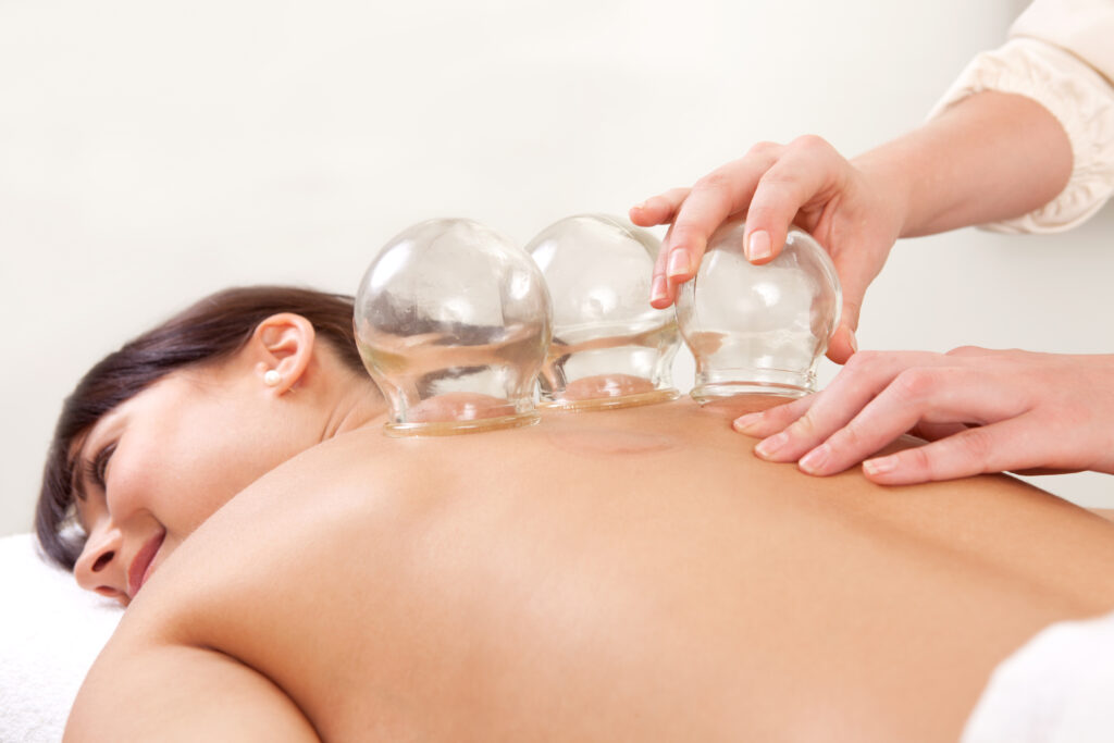 A woman smiles as she undergoes cupping therapy on her back and enjoying the benefits of cupping