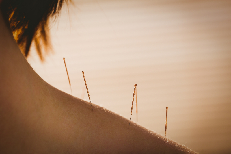 Acupuncture therapy for addiction and mental health in orange county, ca.